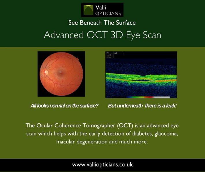 10 Steps to Keeping Eye Fit Valli Opticians